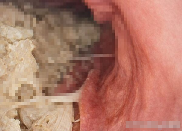 Người phụ nữ 54 tuổi 