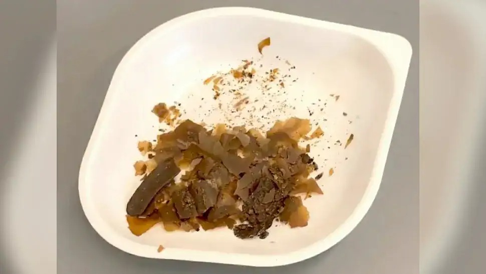 Có thể bạn chưa biết, vào thời La Mã người ta đã sử dụng phân người làm thuốc - Ảnh 2.