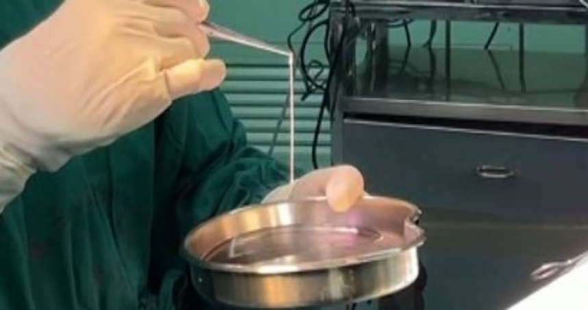 Người phụ nữ 32 tuổi đi ngoài ra sán dài tới 3 mét dù chưa từng ăn đồ sống, bác sĩ chỉ ra 1 thứ bếp nhà nào cũng có chính là thủ phạm- Ảnh 2.