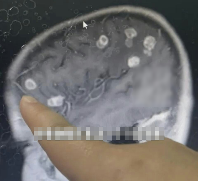 B&eacute; g&aacute;i 6 tuổi bị "đục" 20 lỗ ở n&atilde;o, su&yacute;t th&agrave;nh người thực vật: 5 g&oacute;c khuất chứa đầy &ldquo;chất độc v&ocirc; h&igrave;nh&rdquo; phải cẩn trọng khi dọn dẹp nh&agrave; đ&oacute;n Tết- Ảnh 1.