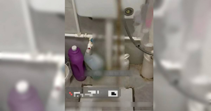 Người phụ nữ 32 tuổi đi ngoài ra sán dài tới 3 mét dù chưa từng ăn đồ sống, bác sĩ chỉ ra 1 thứ bếp nhà nào cũng có chính là thủ phạm- Ảnh 1.