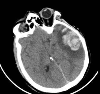 Cứu Sống Mẹ Con Du Khách Nga Bị Tai Nạn Nghiêm Trọng Tại Tphcm - Ảnh 2.