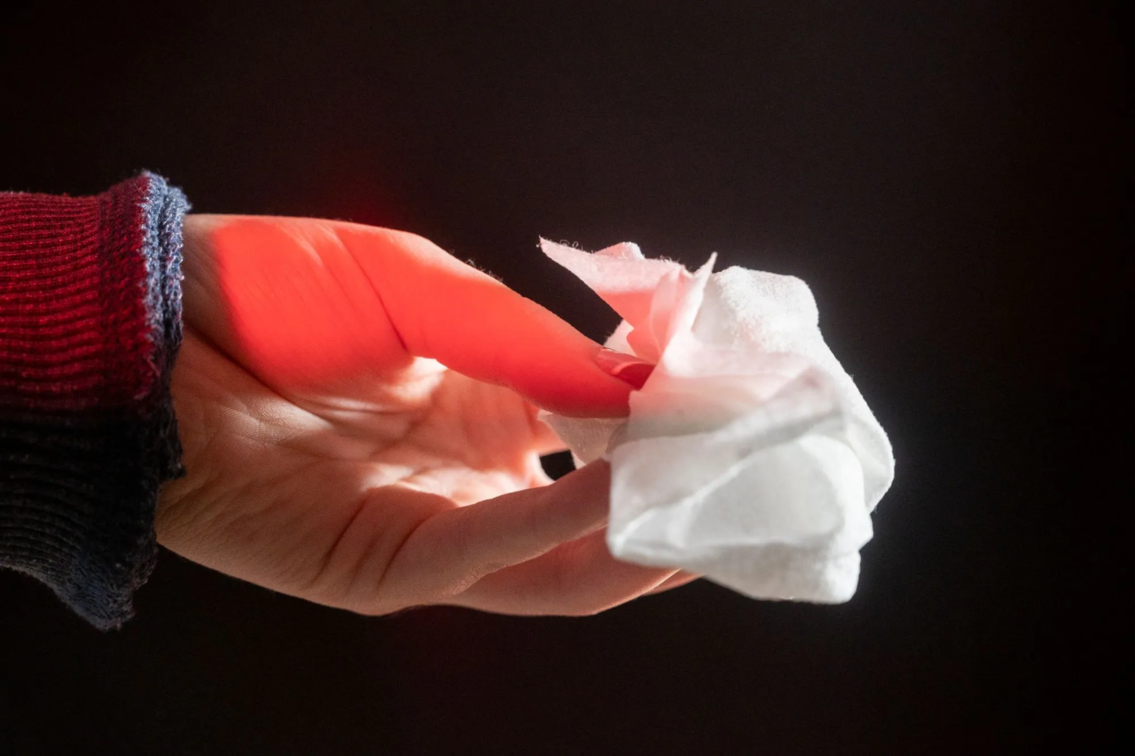 Cảnh b&aacute;o khẩn về khăn ướt: H&agrave;ng chục người nhiễm vi khuẩn nguy hiểm, 1 trường hợp đ&atilde; tử vong- Ảnh 2.