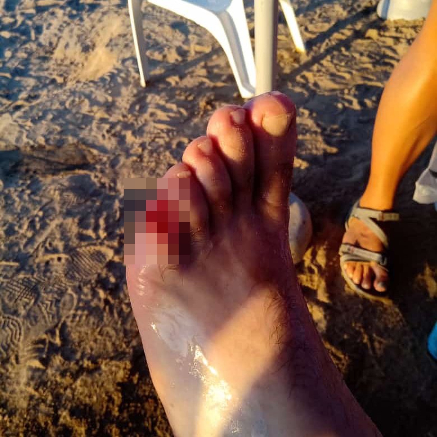 Hàng chục người bị cá ăn thịt tấn công khi tắm sông ở Argentina- Ảnh 1.