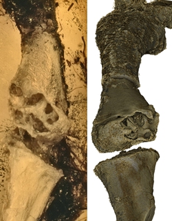 H&eacute; lộ manh mối về nguồn gốc của bệnh u xương- Ảnh 1.