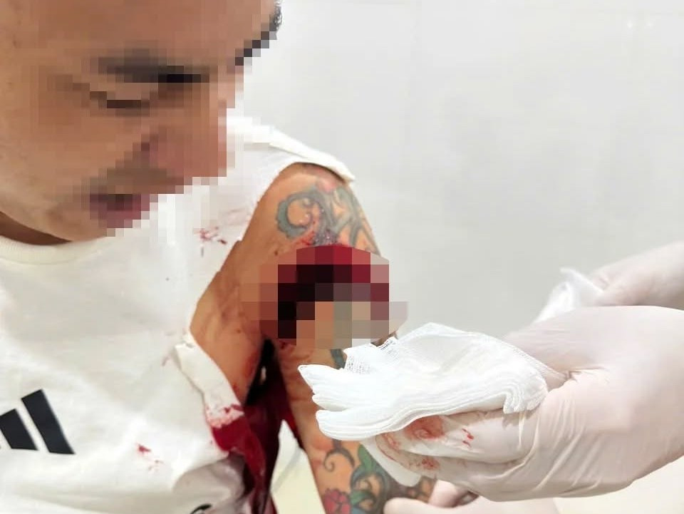 Người đ&agrave;n &ocirc;ng bị ch&eacute;m trọng thương khi uống c&agrave; ph&ecirc; tại Nghệ An - Ảnh 1.