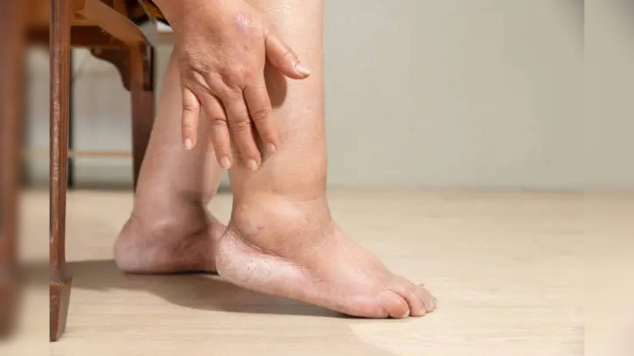 Muốn biết thận khỏe hay yếu, cứ nhìn vào tay và chân sẽ rõ: Có 7 dấu hiệu này thì phải đi khám sớm! - Ảnh 1. Muốn biết thận khỏe hay yếu, cứ nhìn vào tay và chân sẽ rõ: Có 7 dấu hiệu này thì phải đi khám sớm! - Ảnh 1.