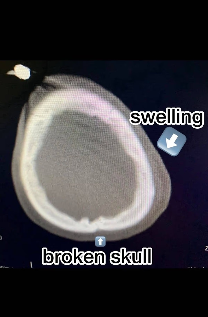 Ch&agrave;ng trai chấn thương n&atilde;o nặng gặp Ch&uacute;a v&agrave; hồi phục kỳ diệu - Ảnh 3.