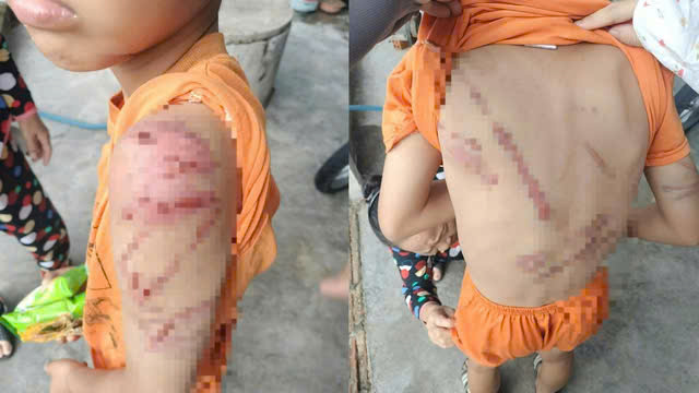 L&yacute; do người cha đ&aacute;nh con 10 tuổi bầm t&iacute;m khắp người - Ảnh 1.