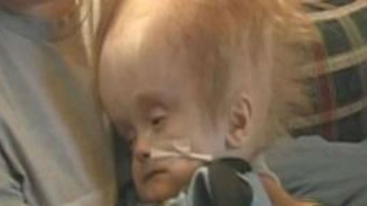 Cậu b&eacute; sinh ra kh&ocirc;ng c&oacute; n&atilde;o đ&atilde; sống cuộc đời như thế n&agrave;o?- Ảnh 2.