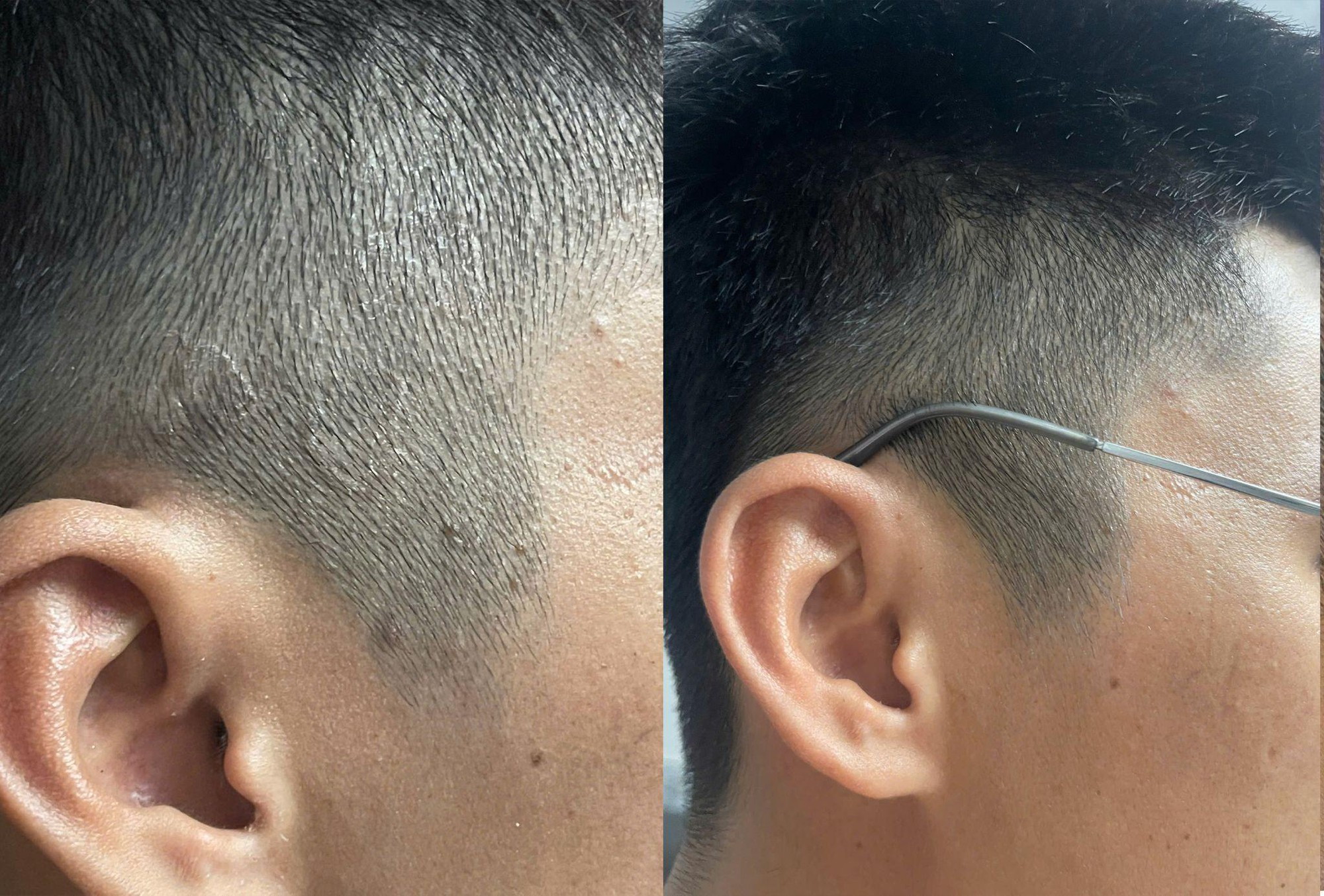 Xu hướng chăm s&oacute;c da đầu mới: Kh&ocirc;ng chỉ sạch g&agrave;u m&agrave; c&ograve;n phải &ldquo;sạch bền vững&rdquo; - Ảnh 1.