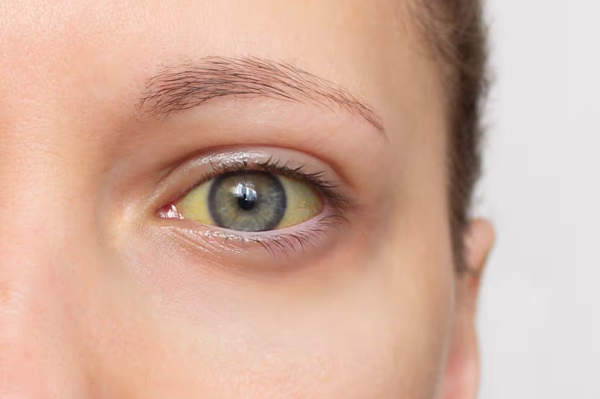 - Ảnh 1. - Ảnh 1.