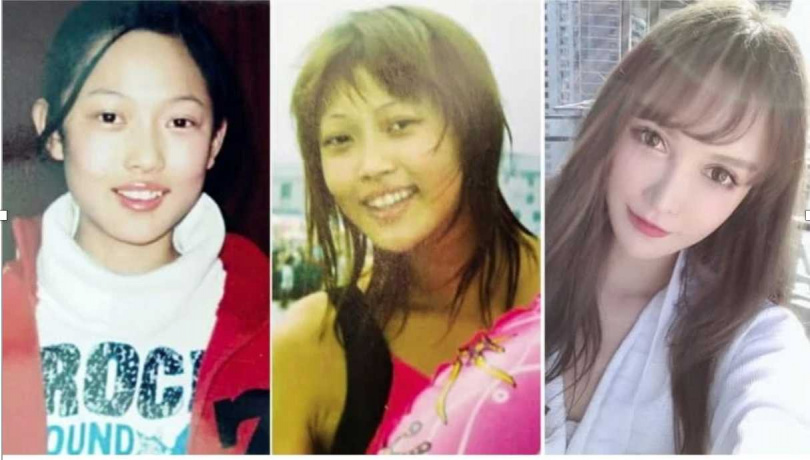 C&ocirc; g&aacute;i cao 1m80 bị &eacute;p dao k&eacute;o từ năm 14 tuổi, hơn 300 lần phẫu thuật: Gương mặt hiện tại thế n&agrave;o? - Ảnh 3.