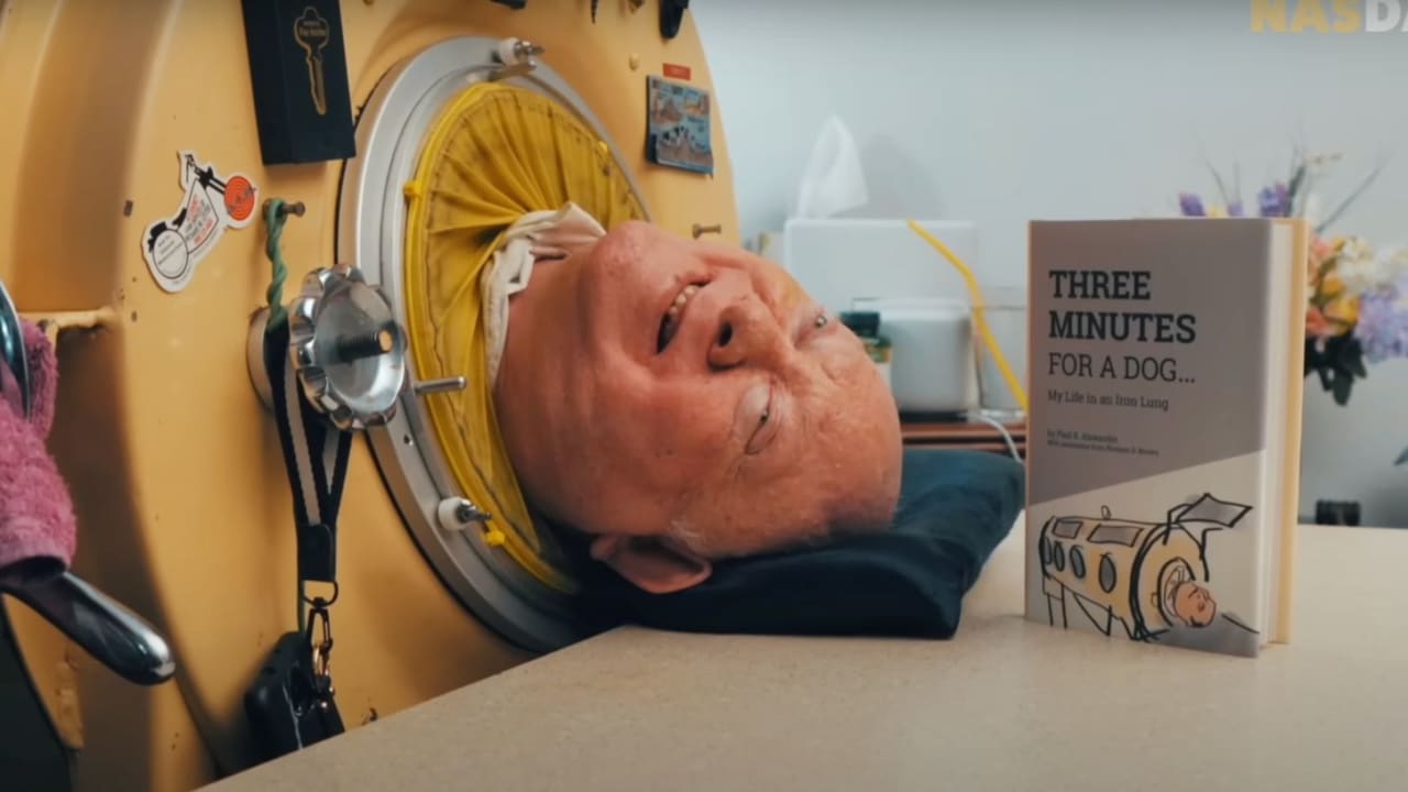 Người đ&agrave;n &ocirc;ng sống trong "phổi sắt" suốt 70 năm - Ảnh 3.