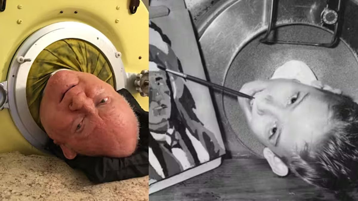 Người đ&agrave;n &ocirc;ng sống trong "phổi sắt" suốt 70 năm - Ảnh 1.