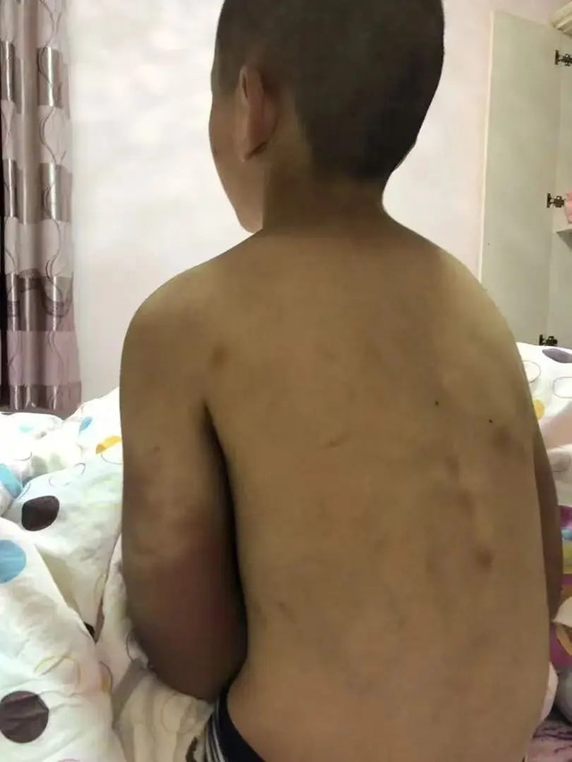 Bi kịch của cậu b&eacute; 14 tuổi mặc t&atilde;: Sự thật đau l&ograve;ng từ gia đ&igrave;nh - Ảnh 4.