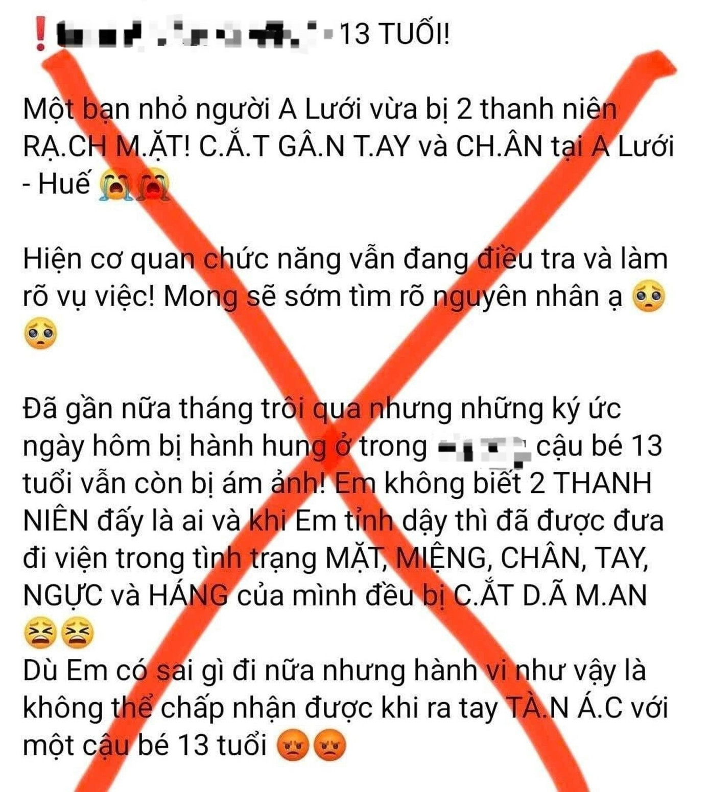 C&ocirc;ng an B&aacute;c tin b&eacute; trai Huế bị cắt g&acirc;n , rạch mặt do tai nạn giao th&ocirc;ng - Ảnh 1.