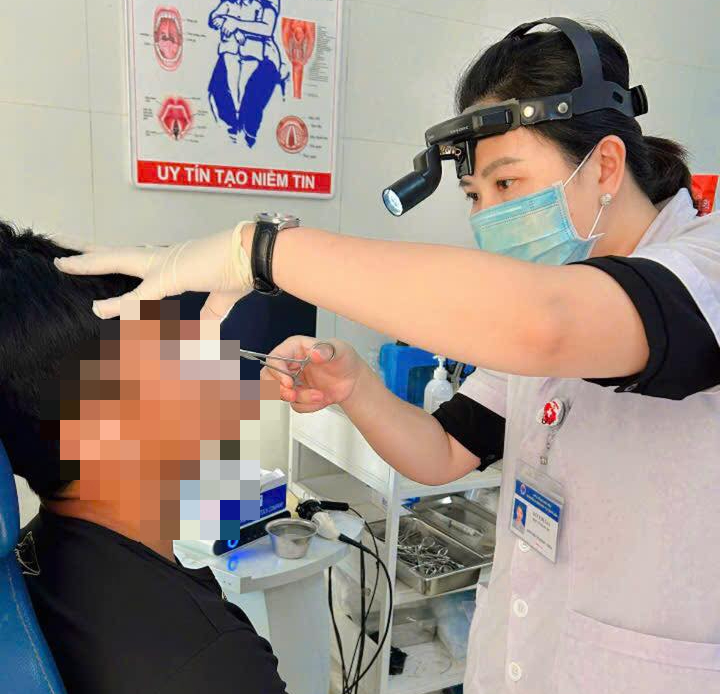 Dị vật kh&ocirc;ng ngờ b&aacute;m nhiều ng&agrave;y trong mũi bệnh nh&acirc;n 38 tuổi - Ảnh 1.