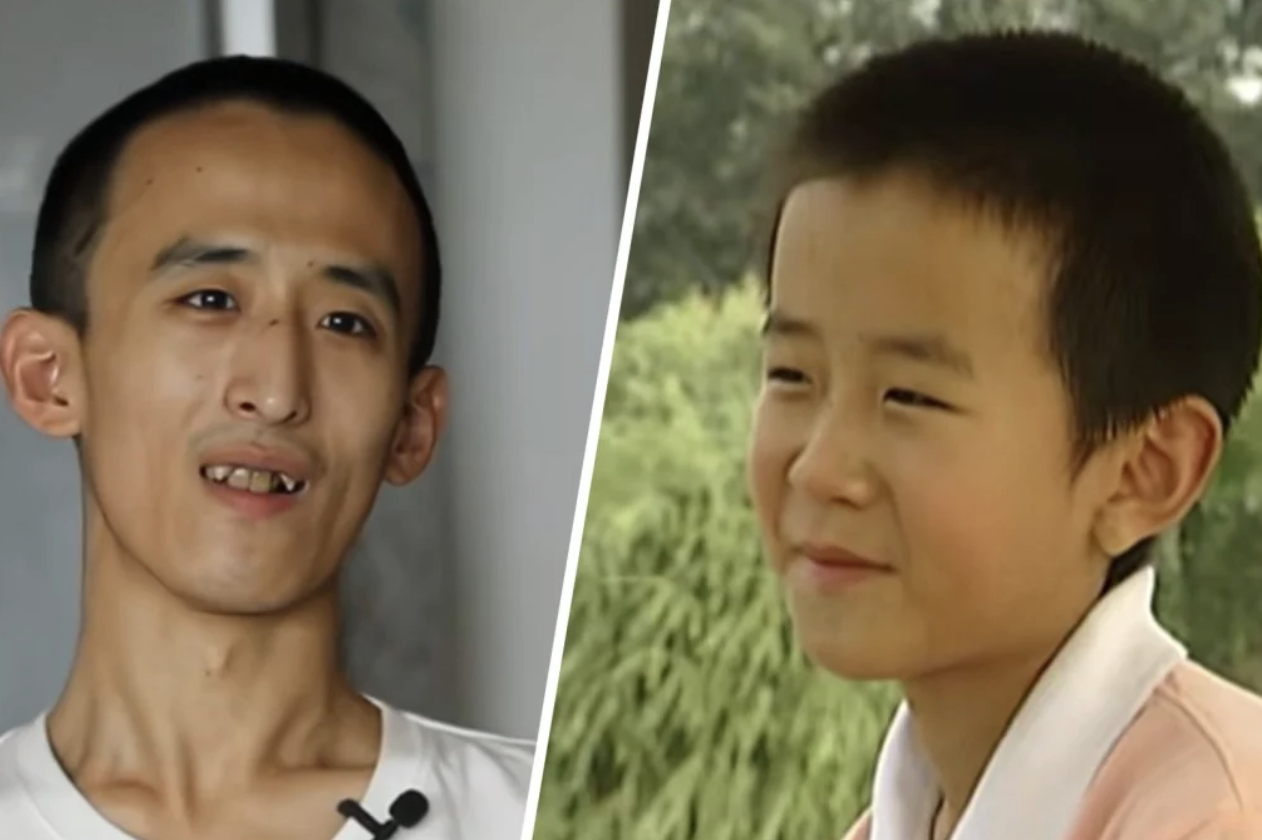 Thần đồng 10 tuổi v&agrave;o đại học, 16 tuổi c&oacute; bằng tiến sĩ giờ ăn b&aacute;m - Ảnh 1.