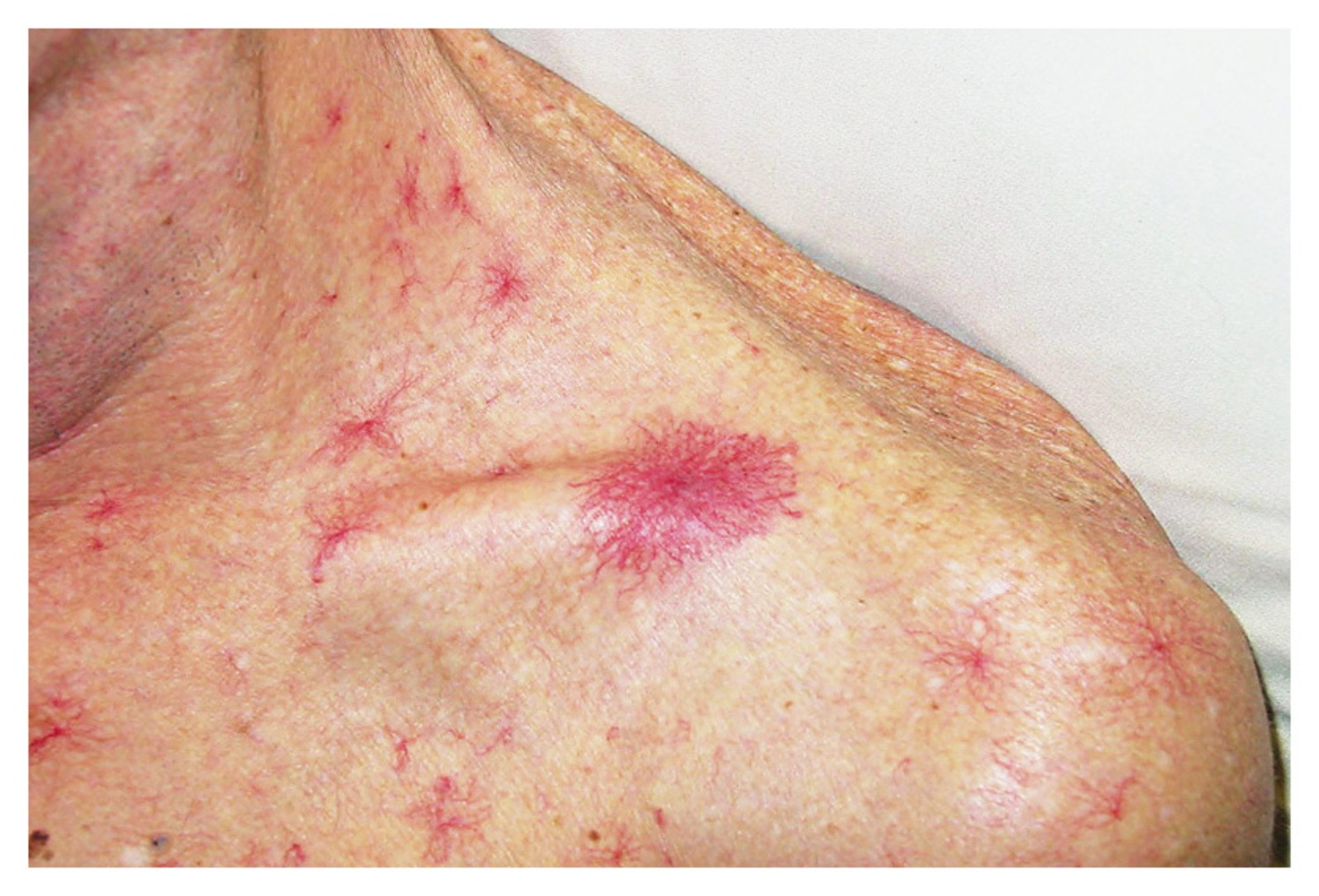 Dau Hieu Ton Thuong Gan 1765671855960 176567185624712691944 1773047521115 1773047521515827304325