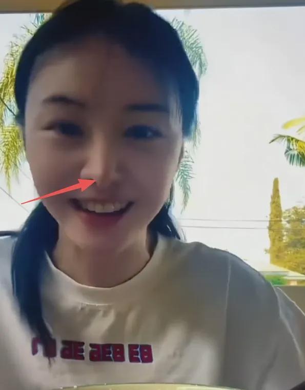 Kh&oacute; tin nổi đ&acirc;y l&agrave; Trịnh Sảng sau khi &ldquo;dao k&eacute;o&rdquo; to&agrave;n bộ gương mặt - Ảnh 5.