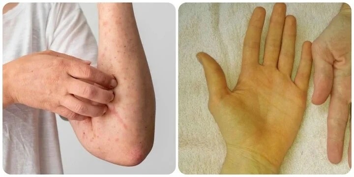 Ung Thu 1773047518842 1773047519637172431122