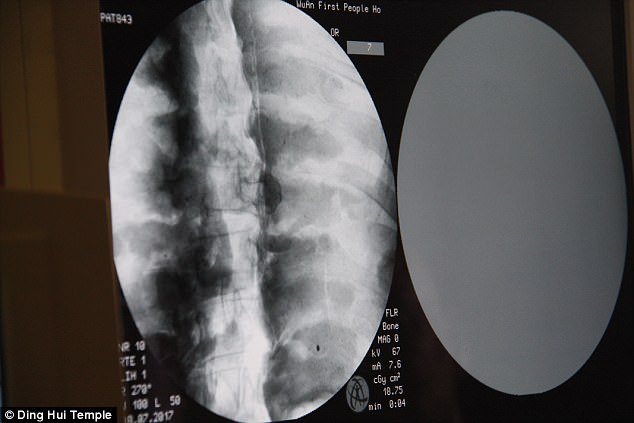 Bức tượng nh&agrave; sư mạ v&agrave;ng 1.000 năm tuổi bất ngờ "hiện nguy&ecirc;n h&igrave;nh" sau khi qu&eacute;t CT: C&ograve;n nguy&ecirc;n bộ n&atilde;o v&agrave; xương- Ảnh 5.