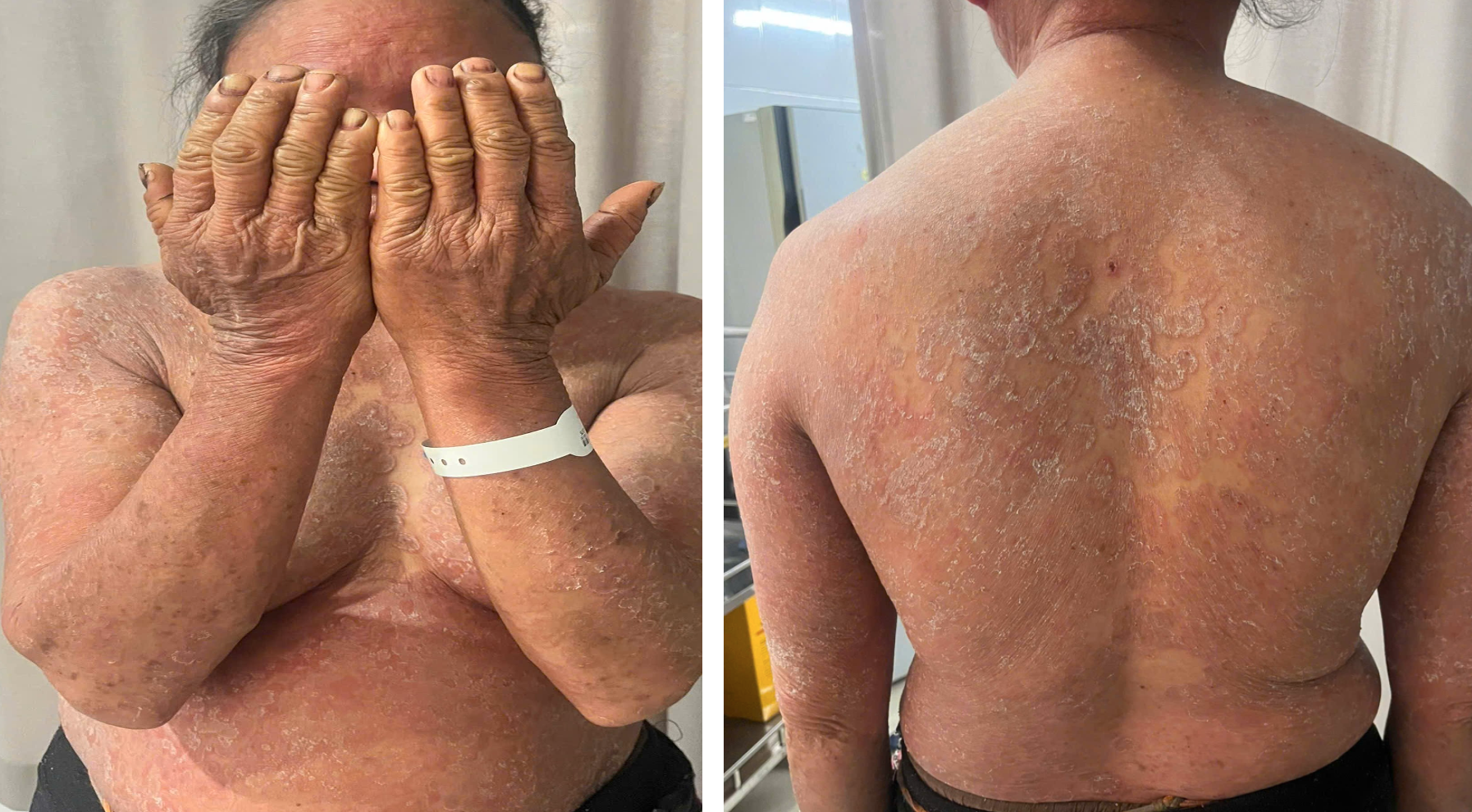 - Ảnh 1. - Ảnh 1.