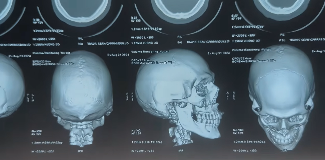 Khách Tây phẫu thuật tại 1 bệnh viện ở Đà Nẵng: 