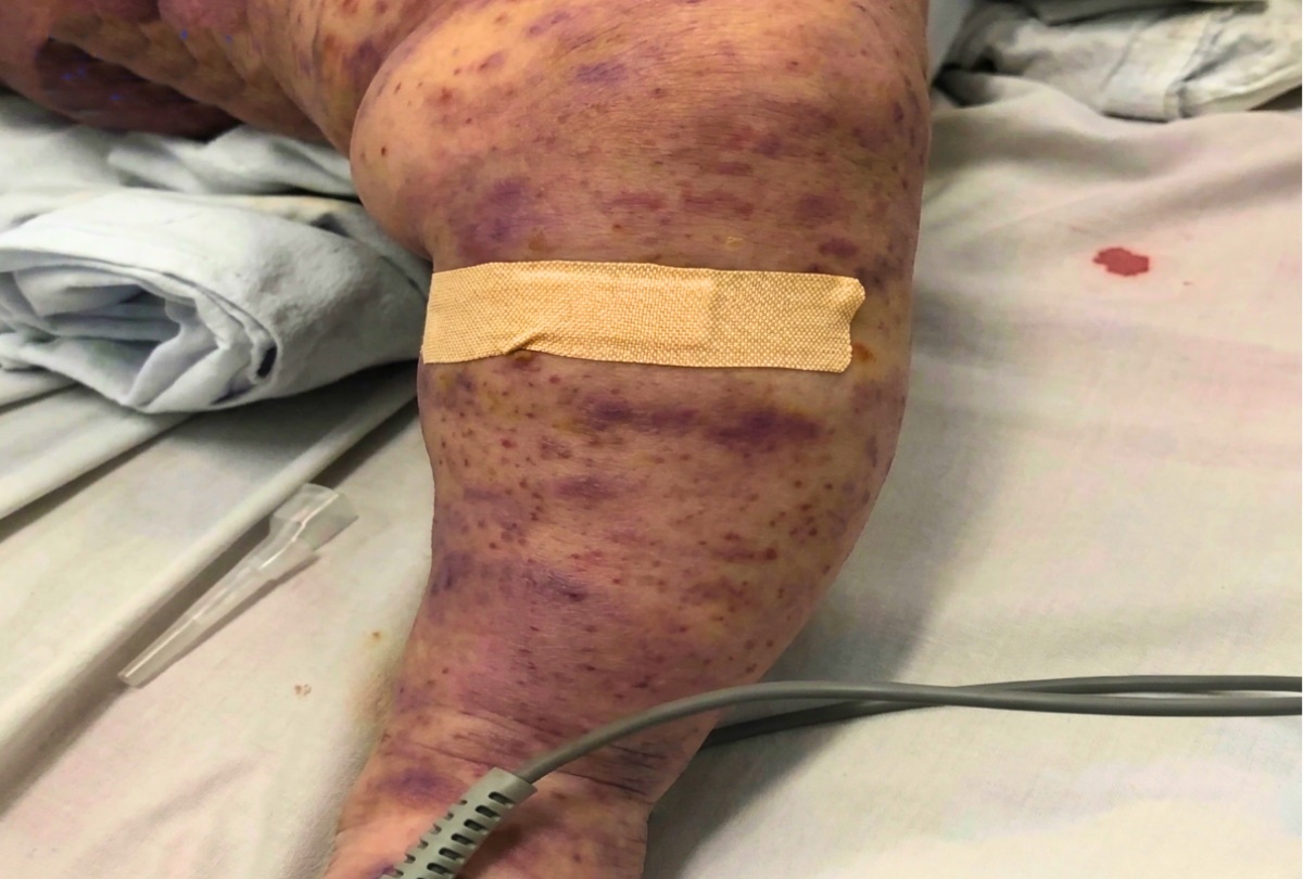 viem nao mo cau 1776348076119 17763480764381881175167