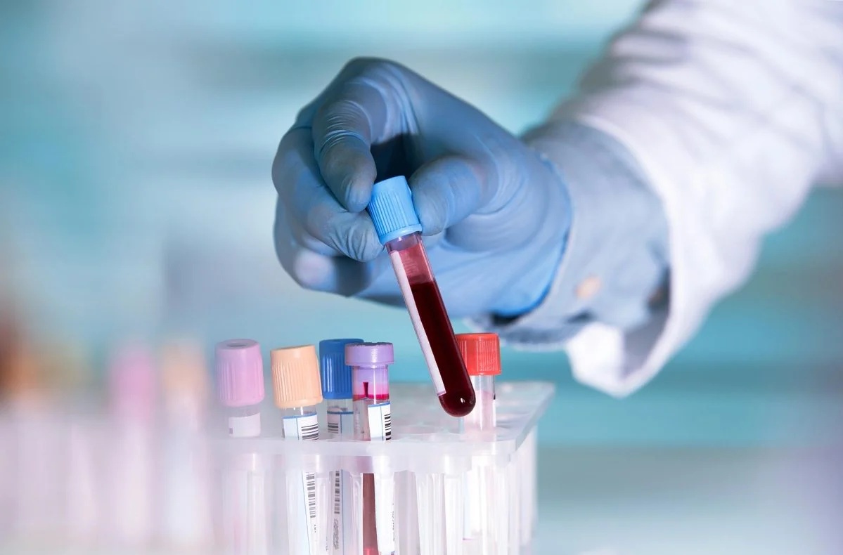  Mỹ ph&aacute;t triển x&eacute;t nghiệm ung thư gi&aacute; rẻ - Ảnh 1.