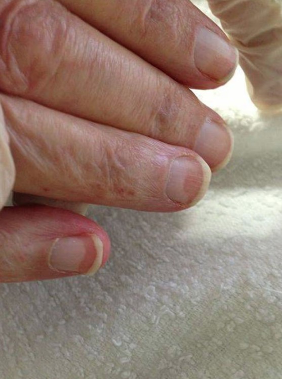 Gan "kêu cứu" bằng cách phát ra dấu hiệu này ở móng tay: Kiểm tra ngay xem bạn có không 20 mong terry 1775117510939 17751175112881278391720