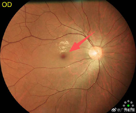 25659af478614b27b4274434c103a947 1776770981479 17767709818221618879466