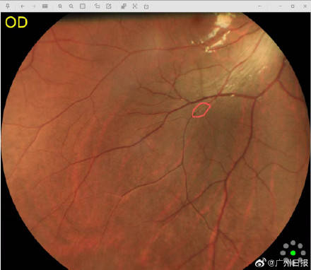 9a97cedfdd4f4ef0a197e4ac0fca1b7c 1776770982569 1776770982978507743907