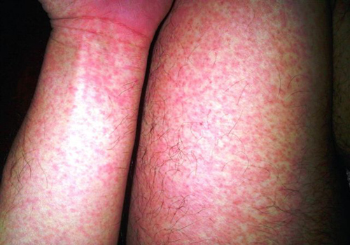 b1 1776931882597 1776931882880651261670