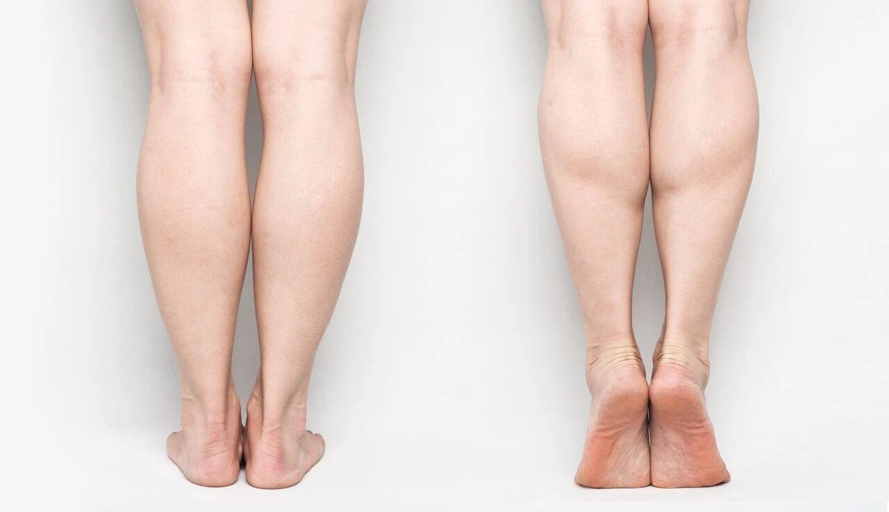 kiengchan3vypf 1776955400833 1776955401327550264345