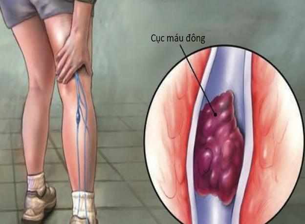 kiengchan4ucvk 1776955400833 1776955401327402609501