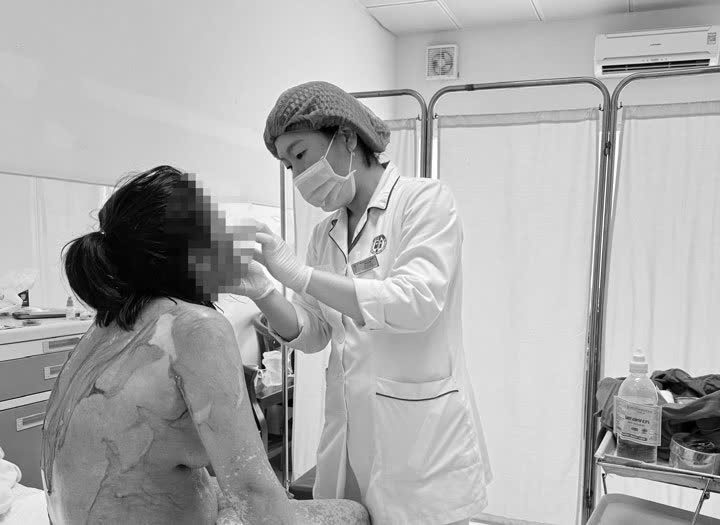 Hải Phòng: 1 phụ nữ 35 tuổi bị tróc da như 