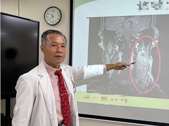 nam giam doc 60 tuoi song lanh manh van mac ung thu bac si tho dai 3 thu tren co dung xem nhe anh2 183043 1777250321093 1777250321356306840411