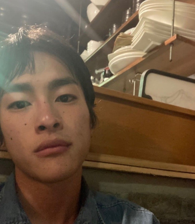 C&aacute;c b&aacute;c sĩ khuy&ecirc;n: Kh&ocirc;ng cần chờ tới l&uacute;c ngứa da, thấy 7 dấu hiệu n&agrave;y tr&ecirc;n mặt tức l&agrave; m&aacute;u đ&atilde; "ngập đường"- Ảnh 3.