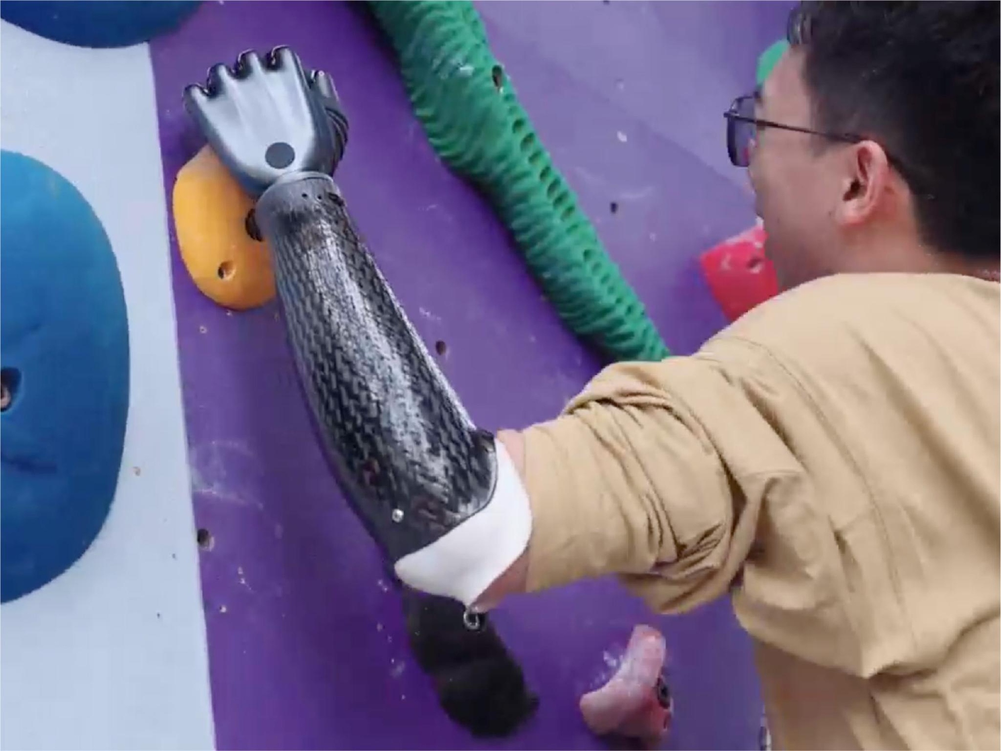 C&aacute;nh tay giả th&ocirc;ng minh Revo2 của Trung Quốc mang lại hy vọng mới cho người khuyết tật - Ảnh 4.