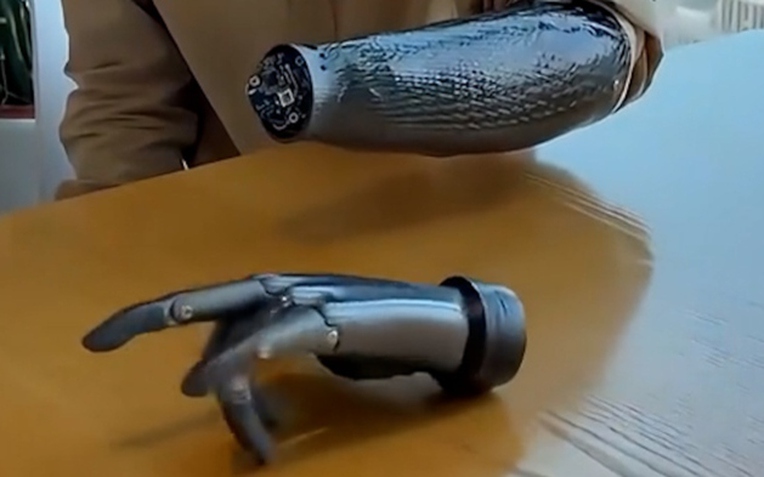 C&aacute;nh tay giả th&ocirc;ng minh Revo2 của Trung Quốc mang lại hy vọng mới cho người khuyết tật - Ảnh 1.