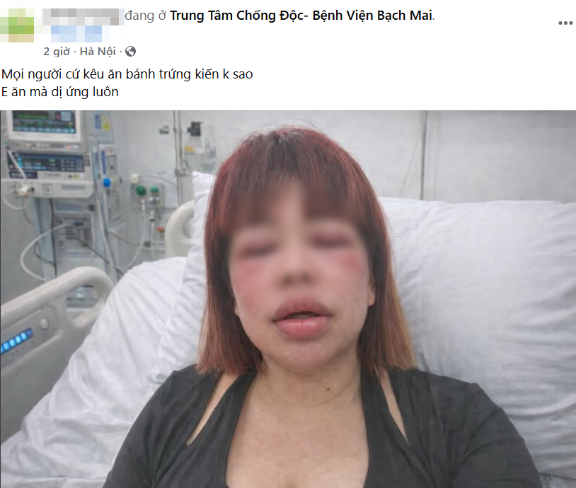 B&aacute;nh trứng kiến Tết Thanh Minh: Nguy cơ dị ứng v&agrave; trải nghiệm ẩm thực th&uacute; vị - Ảnh 2.