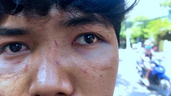 Cụ bà bị nam thanh niên hành hung ở quán ăn khuya: Một gia đình đến thăm hỏi, xin được bỏ qua - Ảnh 2.