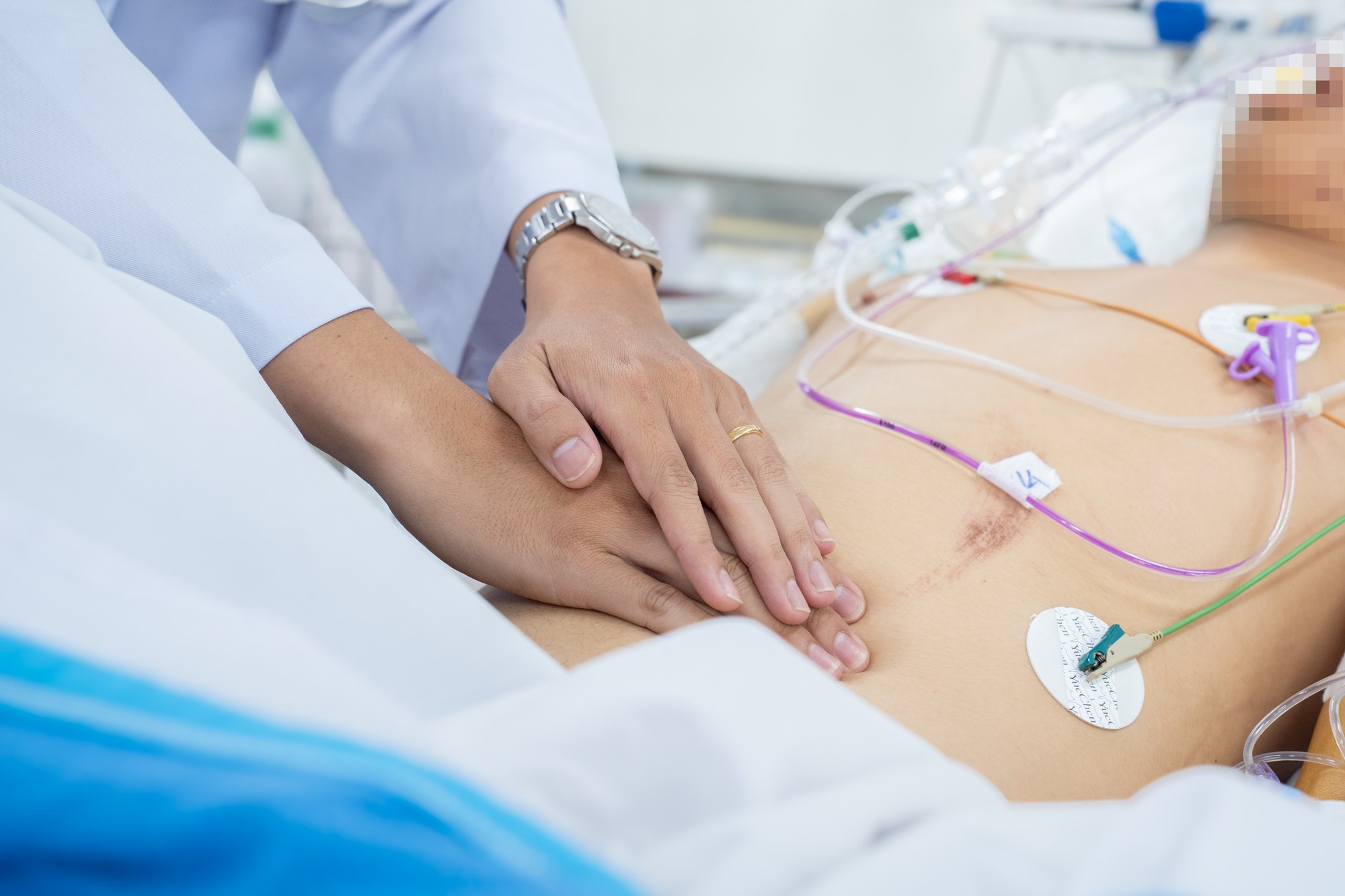 Bác sĩ Bệnh viện Chợ Rẫy mổ xuyên đêm cứu 2 nạn nhân vụ xe khách rơi xuống vực 21 Bác sĩ Bệnh viện Chợ Rẫy mổ xuyên đêm cứu 2 nạn nhân vụ xe khách rơi xuống vực - Ảnh 3.