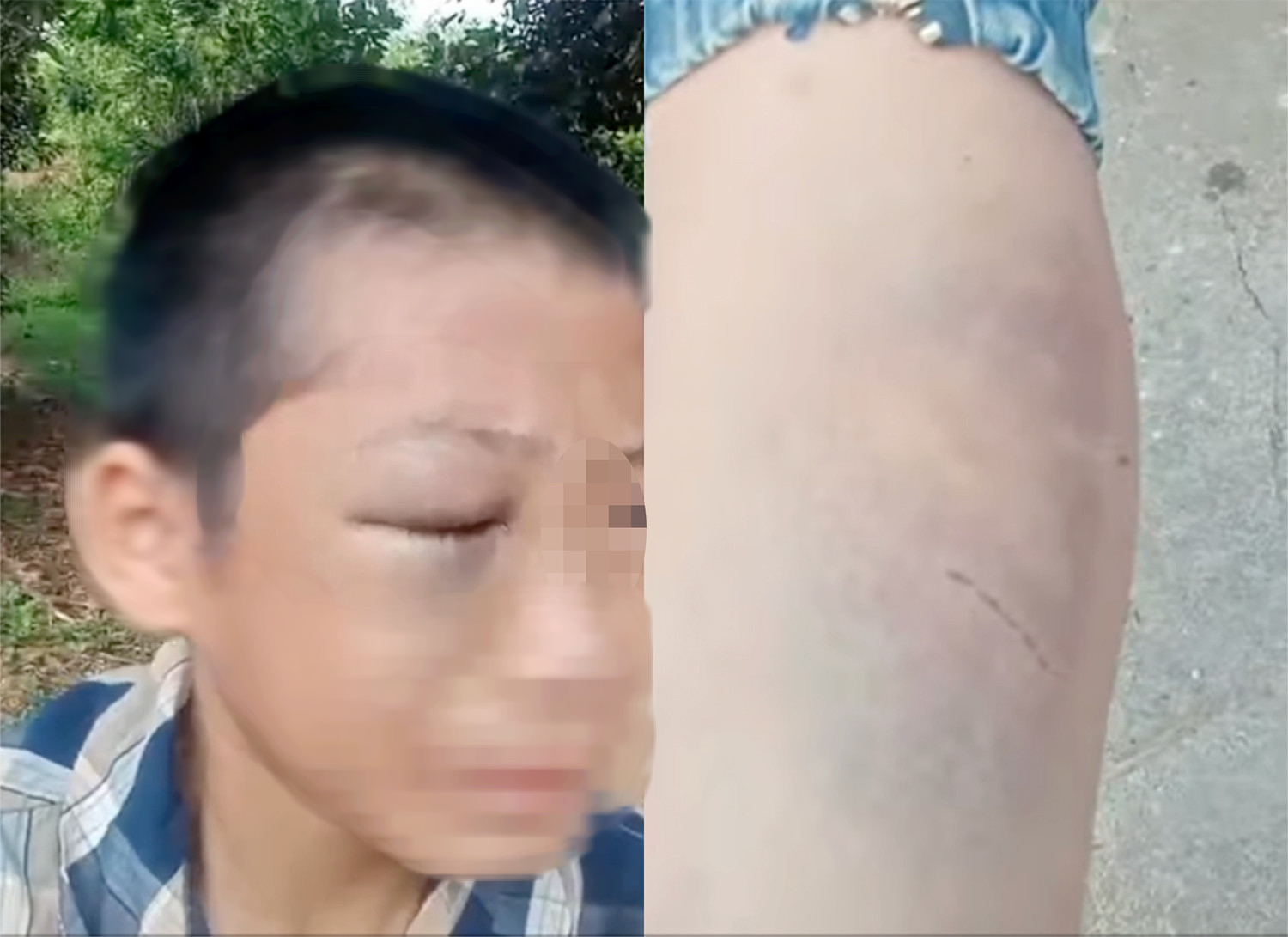 Clip bé trai bầm tím kêu cứu vì bị đánh đập tại Nghệ An gây Xôn xao Mạng xã hội - Ảnh 1. Clip bé trai bầm tím kêu cứu vì bị đánh đập tại Nghệ An gây Xôn xao Mạng xã hội - Ảnh 1.