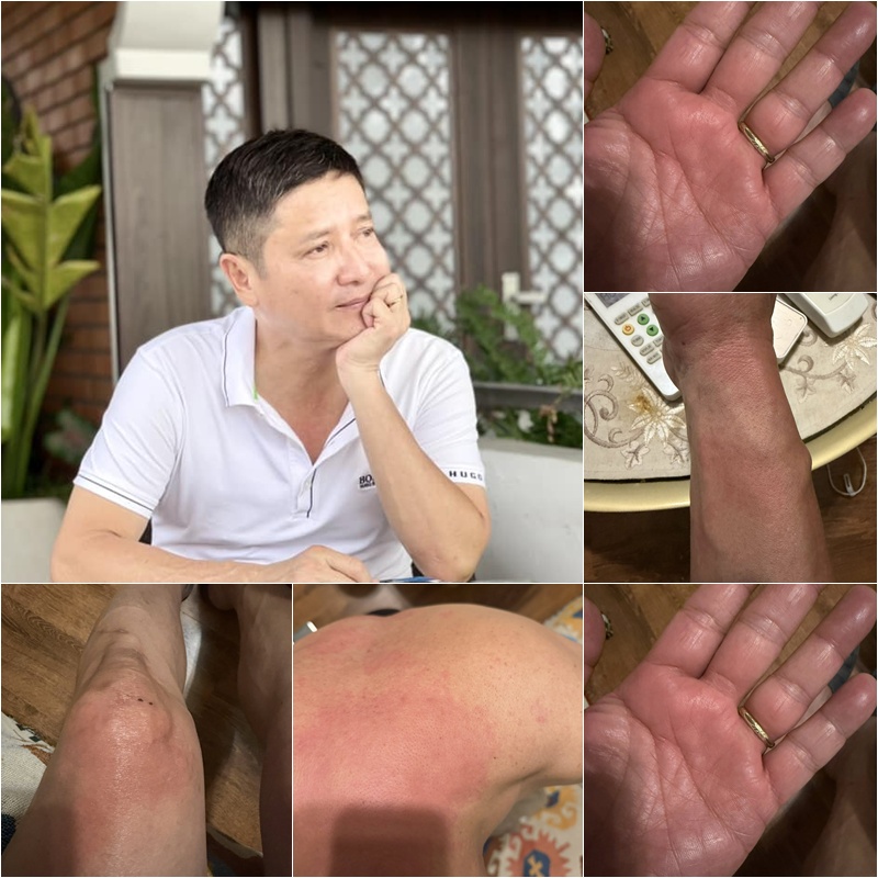  - Ảnh 1.