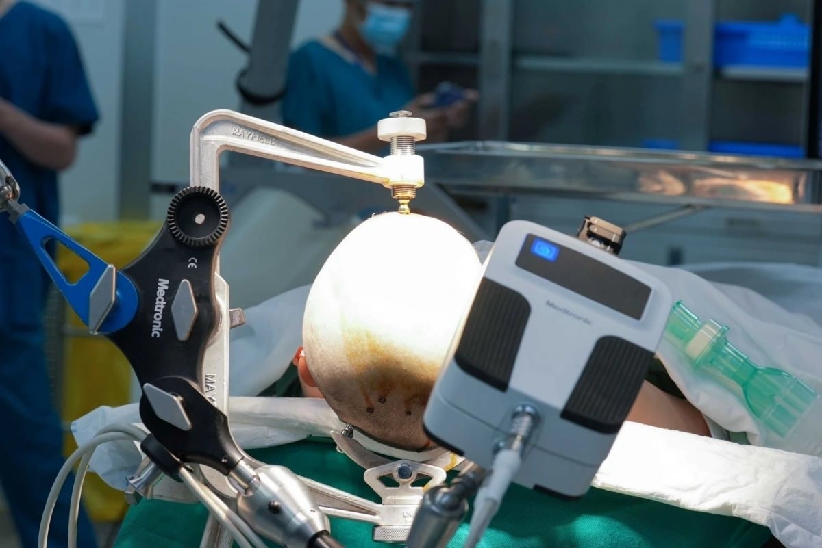 Trước khi th&agrave;nh lập VinSurgical, bệnh viện của tỷ ph&uacute; Phạm Nhật Vượng đ&atilde; nhập từ Mỹ những si&ecirc;u robot phẫu thuật n&agrave;o? C&oacute; loại lần đầu xuất hiện tại Việt Nam - Ảnh 4.