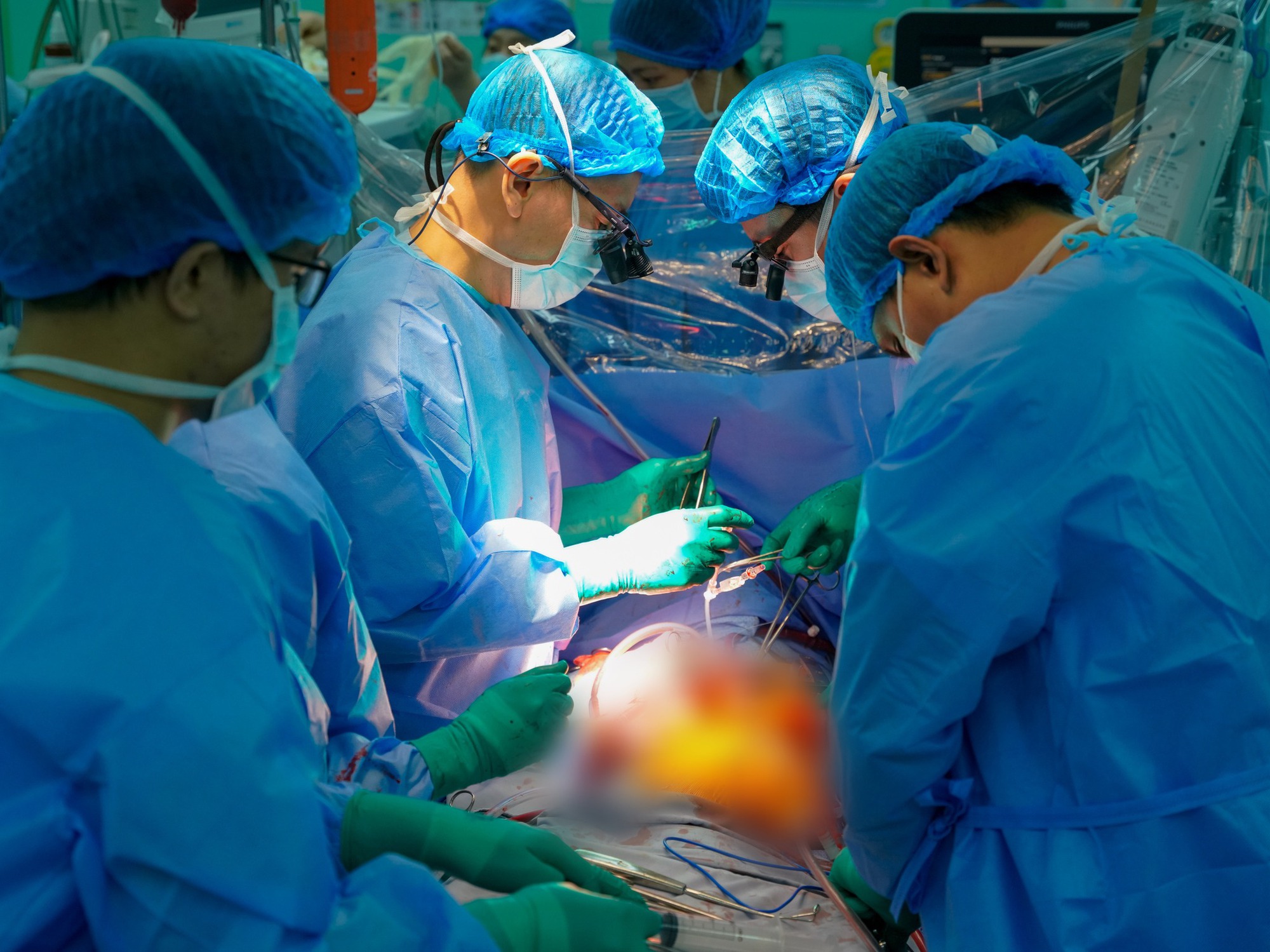 Tr&aacute;i tim bỗng đập trở lại trong lồng ngực người nhận gần ngừng tim, chạy ECMO suốt 8 ng&agrave;y, BS: "Một trong những ca hồi phục tốt nhất m&agrave; ch&uacute;ng t&ocirc;i từng thấy"- Ảnh 3.