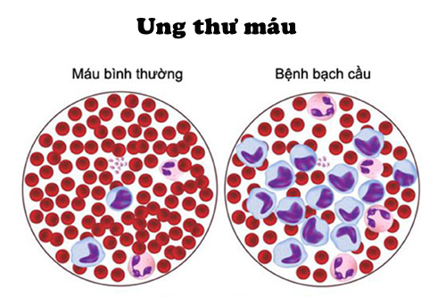  - Ảnh 3.